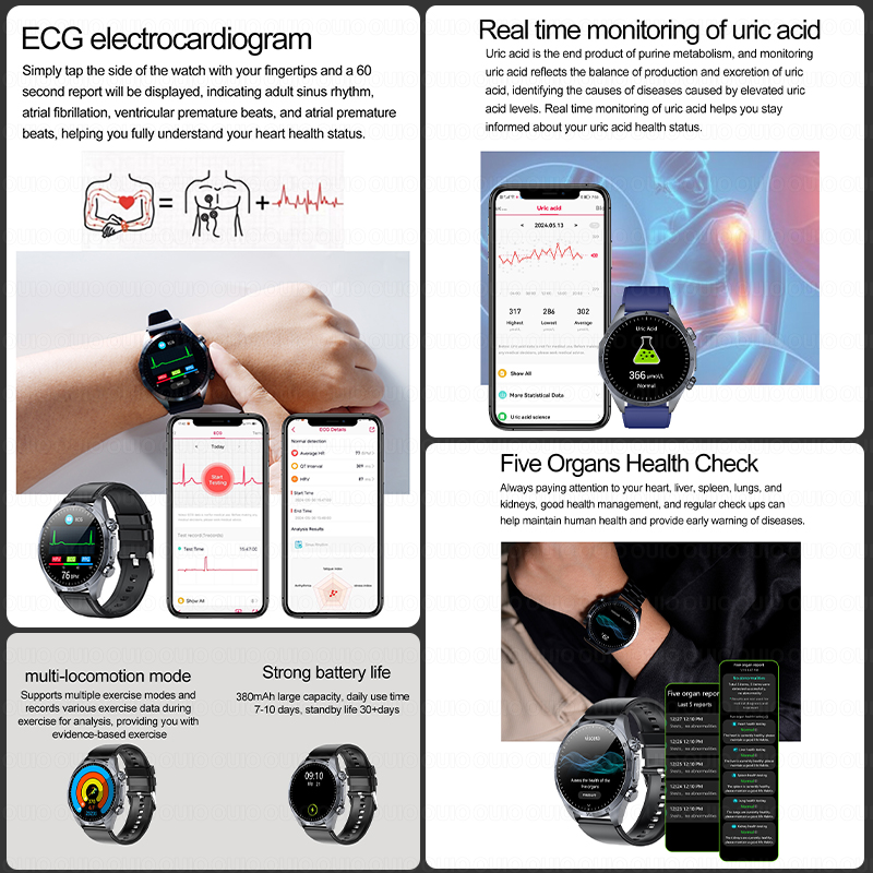 2026 Gloednieuwe Upgrade Gezon - Smartwatch Watches For Women Brands recensie en prijs